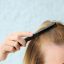Hair Loss in Women – Causes