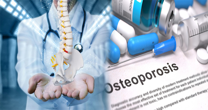 The Osteoporosis Drugs No One Talks About