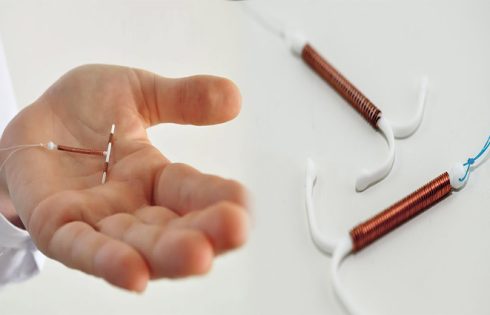 What Women Should Know Before Getting an IUD