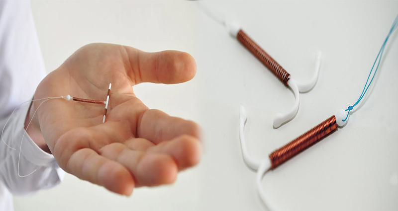 What Women Should Know Before Getting an IUD