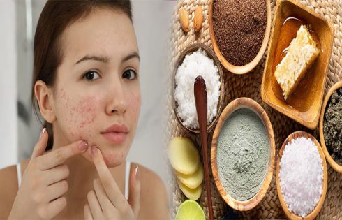 Natural Face Treatments for Women with Acne-Prone Skin