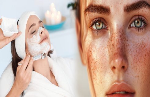 Professional Facial Treatments for Women with Dark Spots
